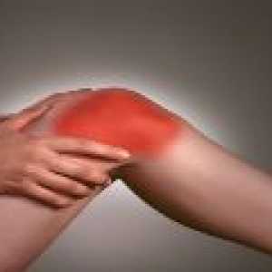 Osteoartritis koljena: uzrokuje, liječenje