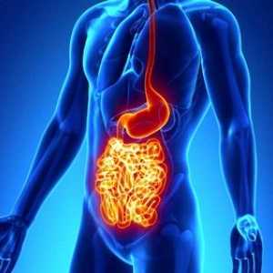 Karakteristični simptomi i tretmani za Crohnovu bolest