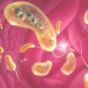 Kolera, simptomi i tretman