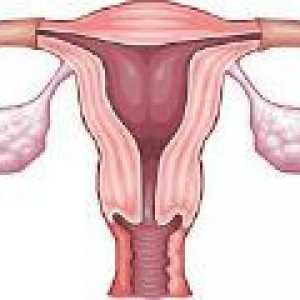 Infantilni maternice kod žena - liječenje