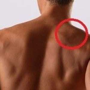 Koji je razlog zašto je bol u ramenu?