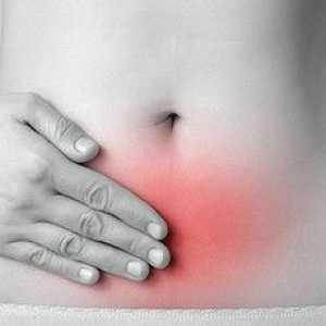 Maternica Endometrioza: Simptomi i liječenje
