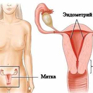 Maternica Endometrioza: Simptomi