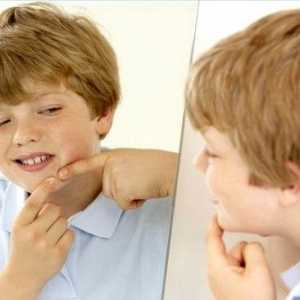 Kako da biste dobili osloboditi od acne na licu tinejdžera