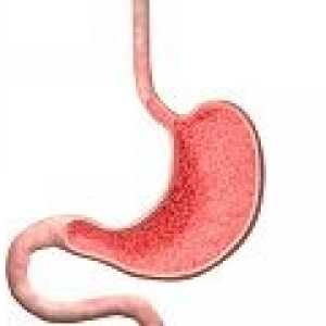 Kako liječiti razoran antralnih gastritis?