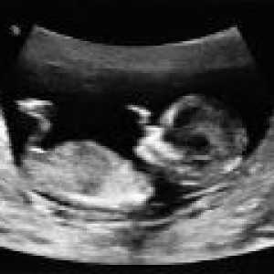 Kako dešifrirati ultrazvuk tijekom trudnoće?