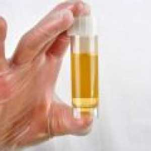 Kako proći test urina tijekom trudnoće?