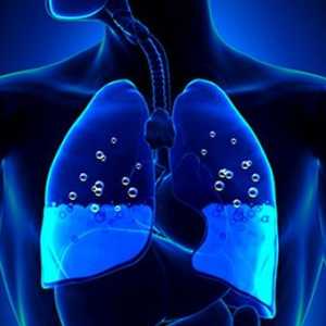 Koji su uzroci i posljedice plućni edem