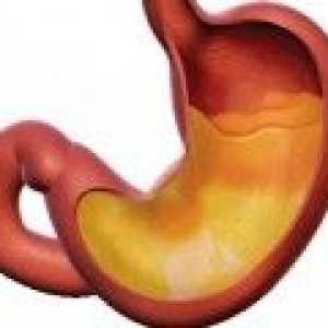 Liječenje gastritisa visoke kiselosti