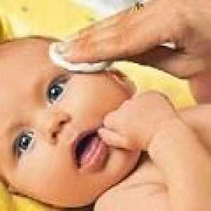 Liječenje konjunktivitisa u djece