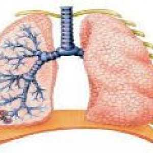 Tretman opstruktivnog bronhitisa