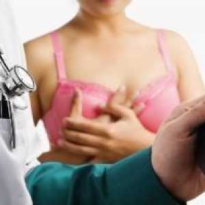Mastektomija - operacija za uklanjanje grudi