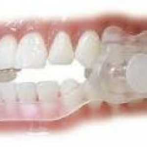 Noć škrgut zubi - uzroci, liječenje