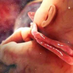 Kabel zaplitanja - strašna dijagnoza ili prijateljski nijansu trudnoće?