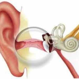 Akutna upala srednjeg uha - u prosjeku, gnojna, katar, akutna upala srednjeg uha kod djece,…