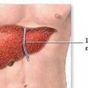 Prvi znakovi ciroze jetre