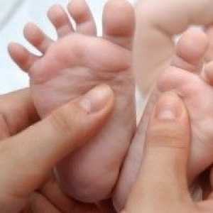 Ravnih stopala u djece, uzroci, liječenje