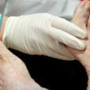 Polineuropatija donjih udova: simptomi, liječenje
