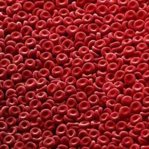 Povišene crvenih krvnih stanica u krvi
