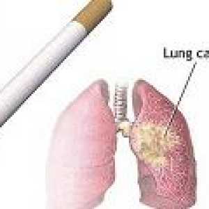 Uzroci raka pluća kod pušača