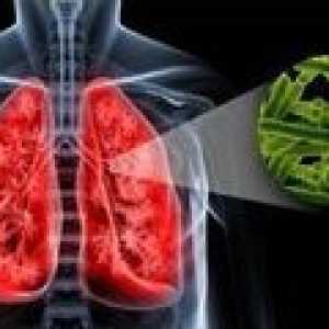 Uzroci plućne tuberkuloze