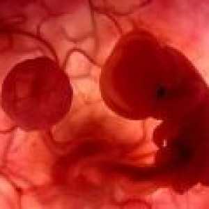 Uzroci pobačaja u ranoj trudnoći