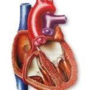 Stečena srčanih bolesti zalistaka
