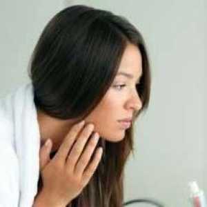 Prištići na obrazima i ispod jagodica: uzroci i preporuke za liječenje