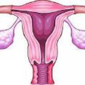 Zadržavanje Ciste jajnika - uzroci, simptomi, liječenje