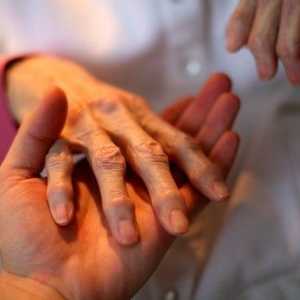 Reumatoidni artritis simptomi prvi