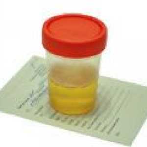 Šećer u urinu tijekom trudnoće, uzrocima, brzini