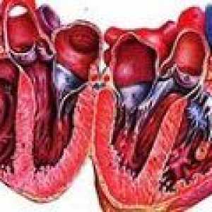 Simptomi i liječenje alkoholičara kardiomiopatije
