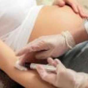 Zgrušavanja krvi tijekom trudnoće, stopa patologije