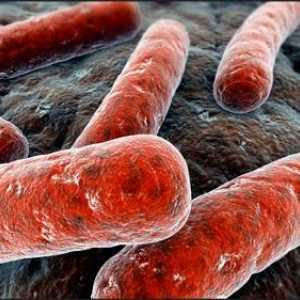Tuberkuloza: Simptomi i liječenje