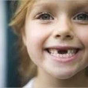 Dijete ne ispasti mliječne zube - uzroci