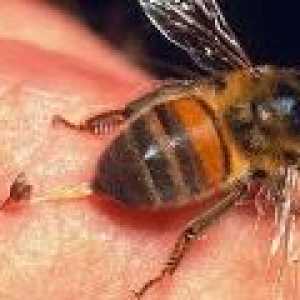 Ubod pčele, osa, Hornet: Tretmani