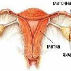 Upala jajnika u žena, simptoma i liječenje