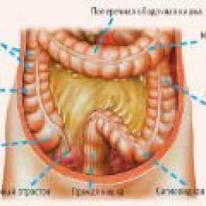 Upala sigmoidalne debelog crijeva: Simptomi i liječenje